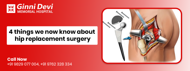 4 things we now know about hip replacement surgery