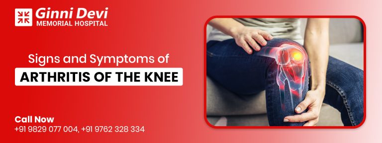 Signs and Symptoms of Arthritis of the Knee