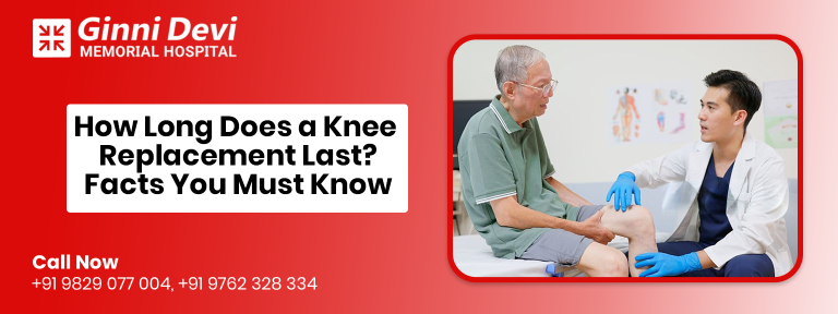 How Long Does a Knee Replacement Last? Facts You Must Know