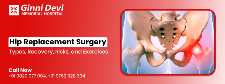 Hip Replacement Surgery: Types, Recovery, Risks, and Exercises
