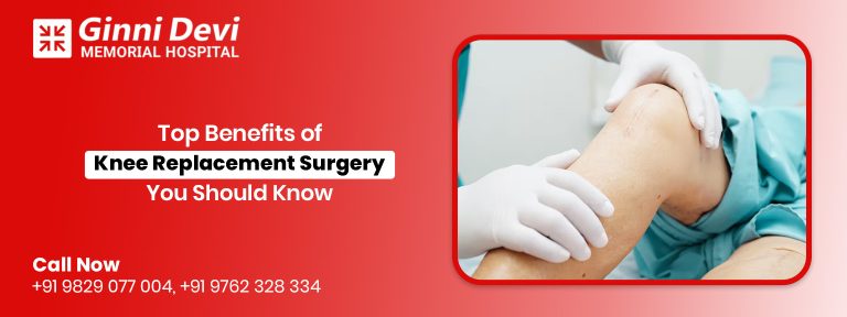 Top Benefits of Knee Replacement Surgery You Should Know