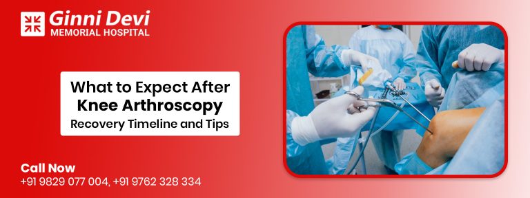 What to Expect After Knee Arthroscopy: Recovery Timeline and Tips