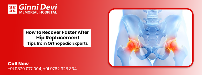 How to Recover Faster After Hip Replacement: Tips from Orthopedic Experts