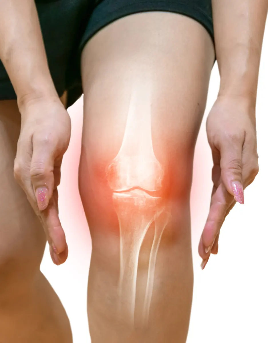 Knee Replacement