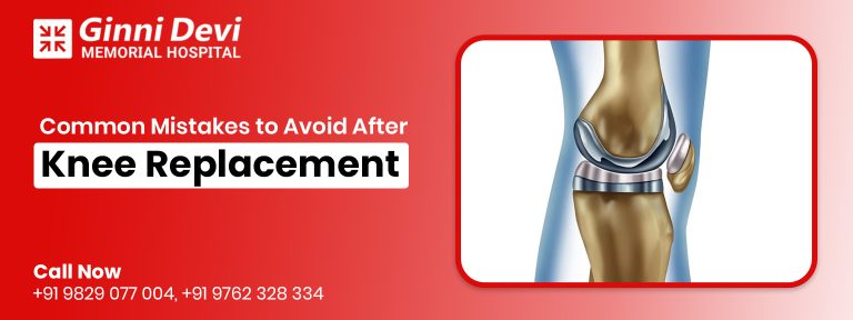 Common Mistakes to Avoid After Knee Replacement