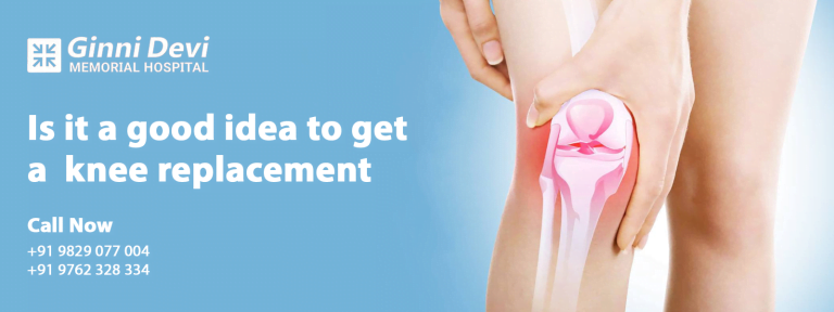 Is it a good idea to get a Knee Replacement