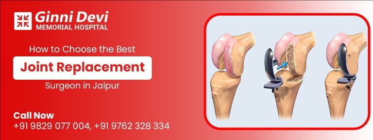 How to Choose the Best Joint Replacement Surgeon in Jaipur